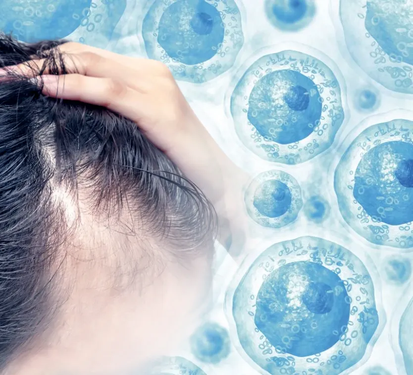 Regenerative Hair Restoration | Stem Cell Hair Regrowth – Tokyo